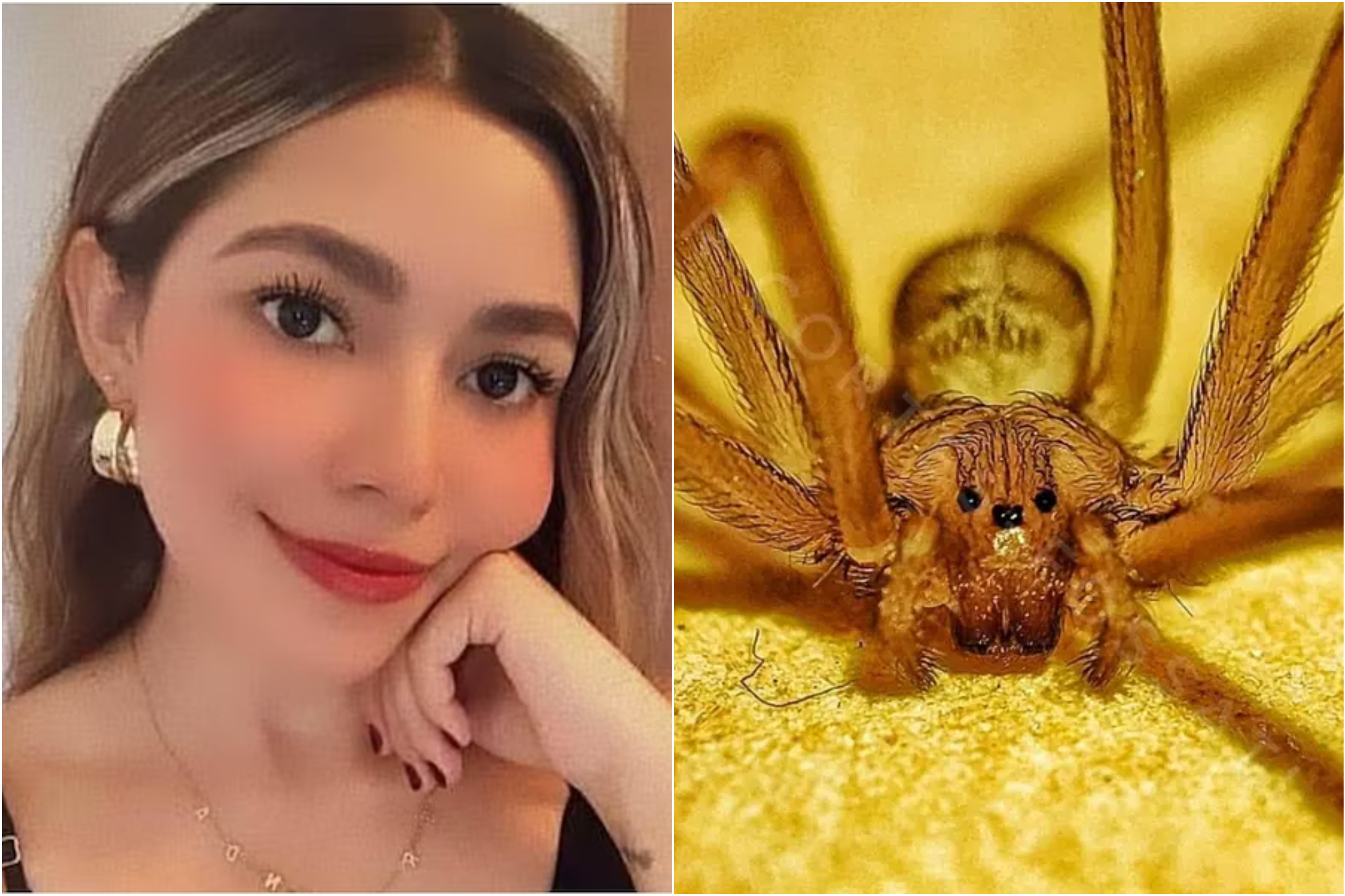 Mar�a Fernanda muri� por complicaciones de la picadura.