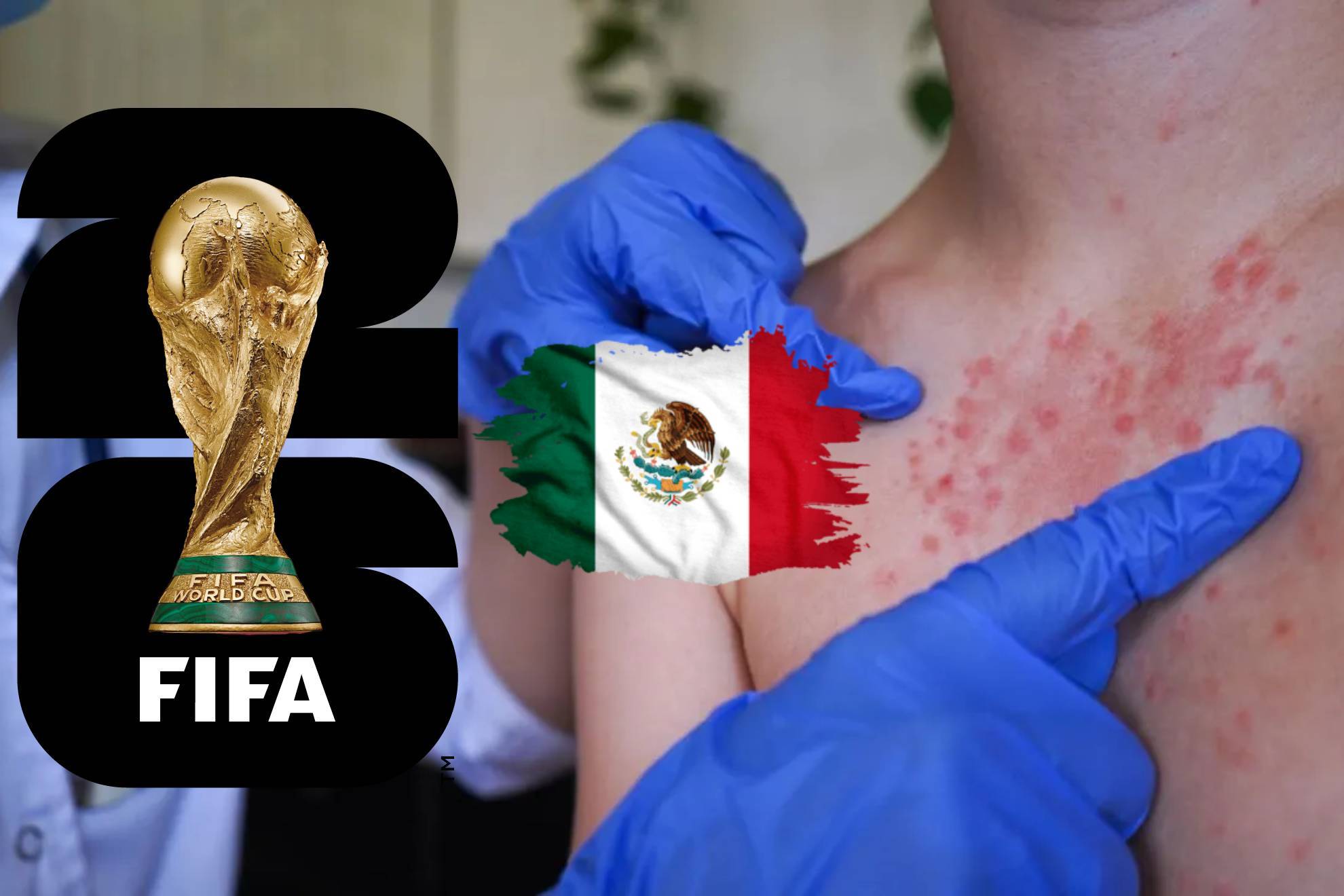 Sarampi�n en M�xico |