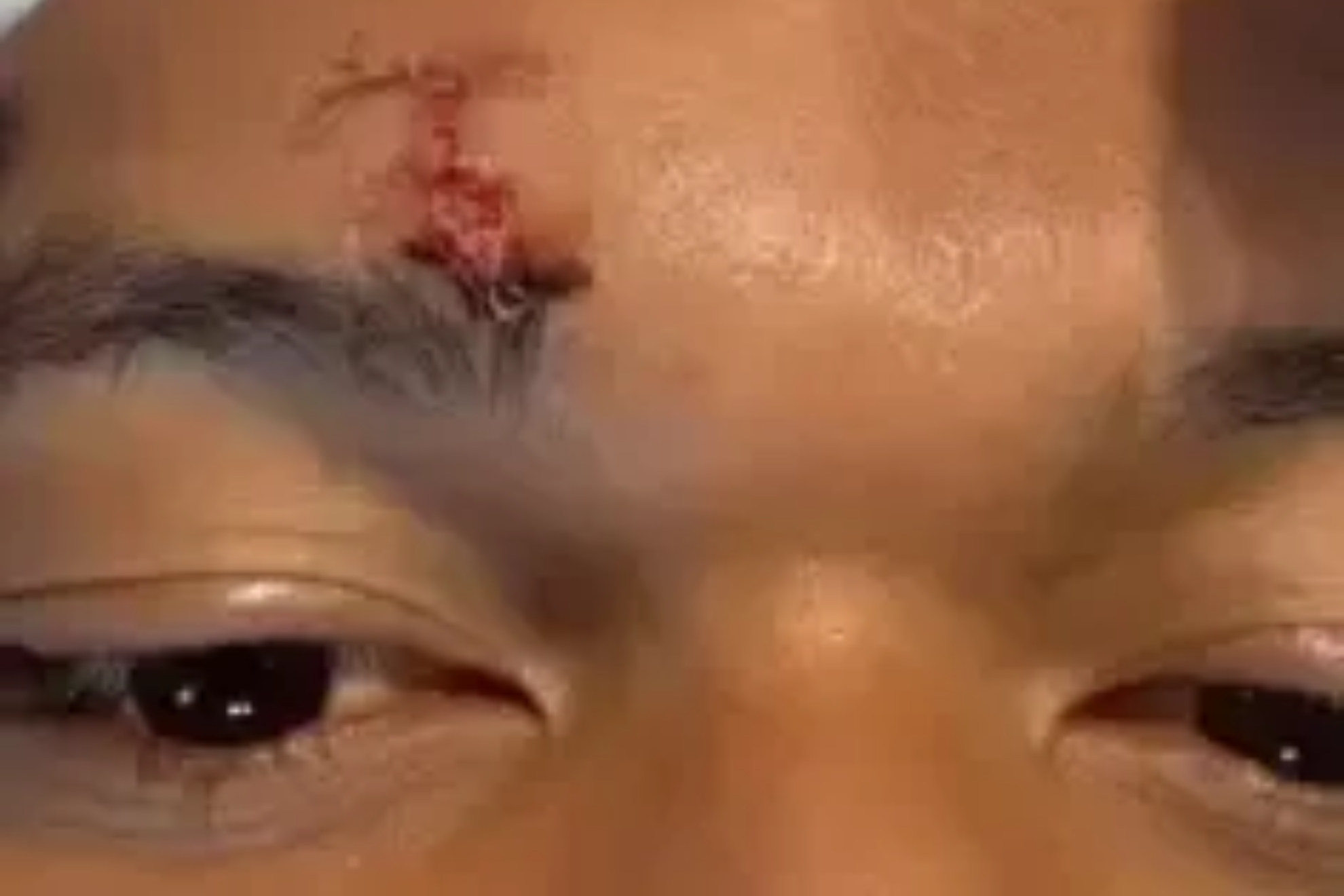 As� qued� la ceja de Mbapp� tras el golpe de Vitor Reis